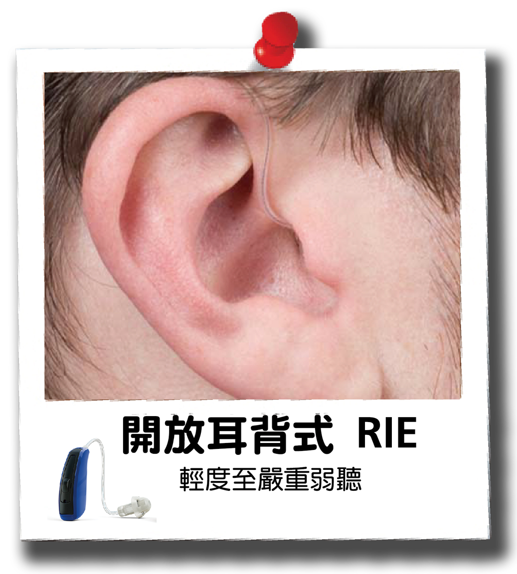 RIE_-1